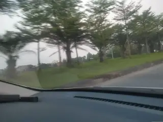 Niềng Răng Bị Tụt Lợi - Nha Khoa Duy Hưng